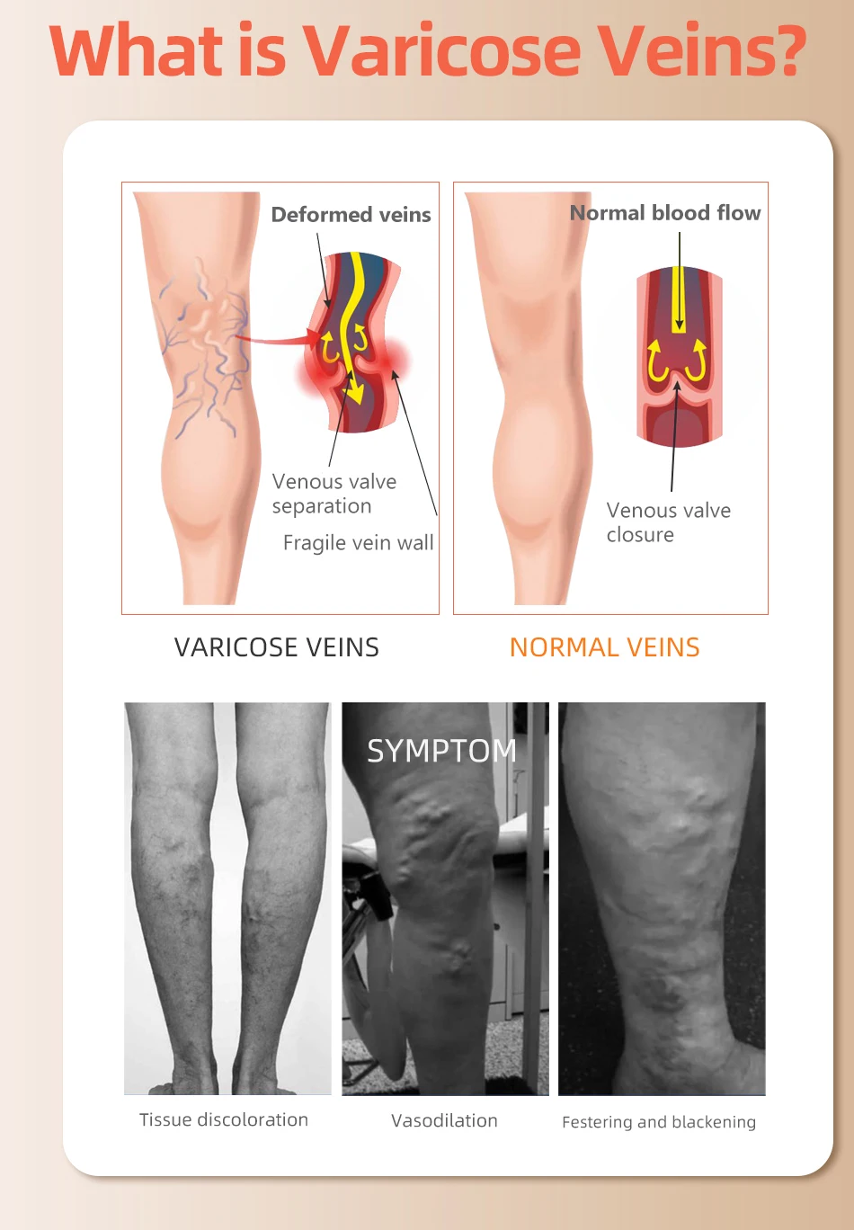 30-40 مم زئبقي فوق الركبة مغلق - مراجعة Compression Sock Medical وسعره